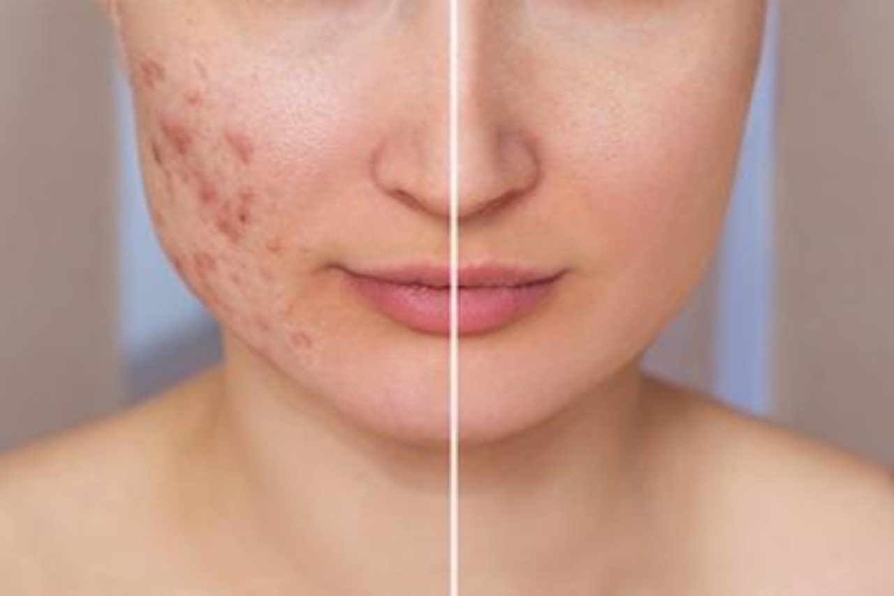 Two Failure Modes That Kill Most Dermatology Content